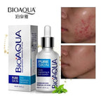 removal of acne bioaqua